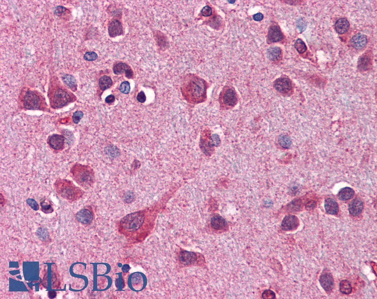 APG12 / ATG12 Antibody (aa79-128)