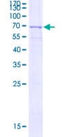 Human AGXT / SPT Protein (Recombinant GST)