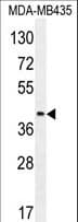 LILRA5 Antibody (aa56-85)