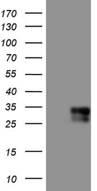 Adiponectin Antibody (aa19-244, clone OTI3G10)
