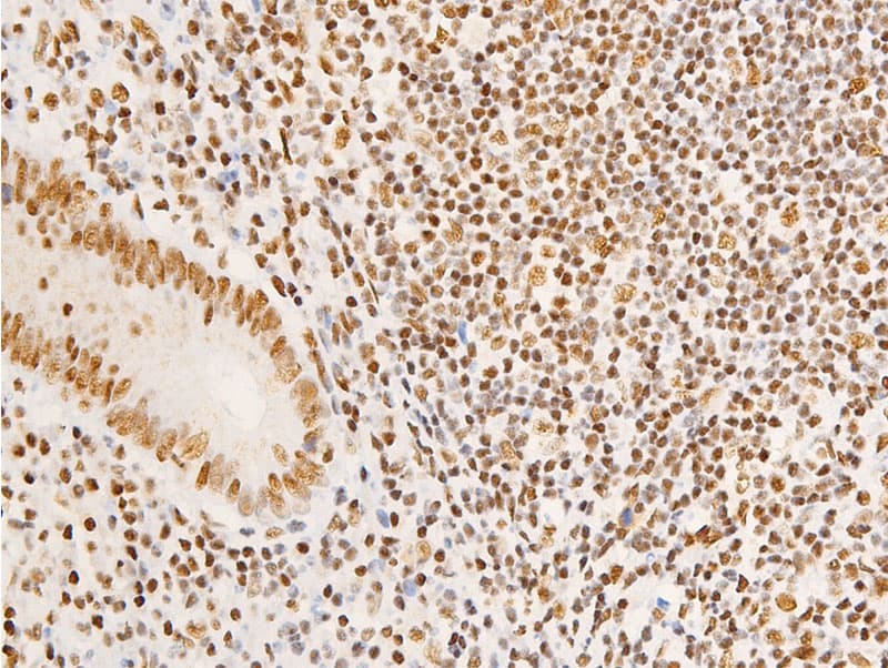 NR3C1/Glucocorticoid Receptor Antibody (phospho-Ser203)