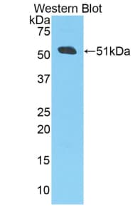 APP / Beta Amyloid Precursor Antibody (aa672-711, PE)