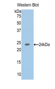 IGFBP6 Antibody (aa31-240, FITC)