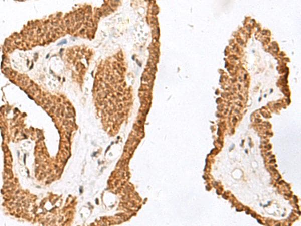 GARNL1 / RALGAPA1 Antibody