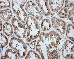 ACSBG1 / hsBG Antibody (clone OTI2B5)
