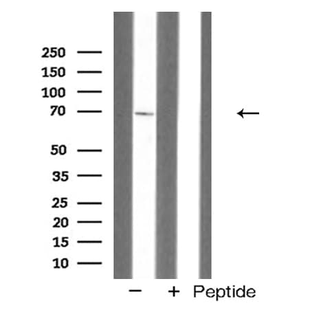 ACHE / Acetylcholinesterase Antibody