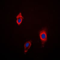 CYP3A4+5 Antibody (Internal)