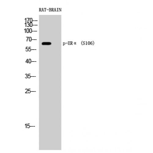 Polyclonal Rabbit anti-Human ER Alpha / Estrogen Receptor Antibody (40-120 aa, IHC, IF, WB)