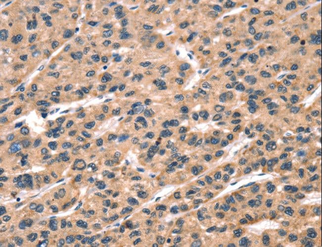 hCG / Chorionic Gonadotropin Antibody