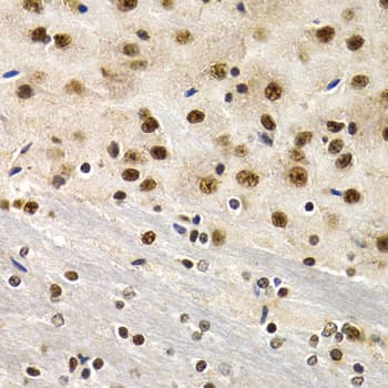 Polyclonal Rabbit anti-Human ID3 Antibody (IHC, IF, WB)