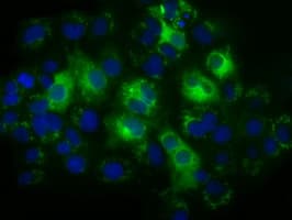 Monoclonal Mouse anti-Human TS / Thromboxane Synthase Antibody (clone OTI1H1, IHC, IF, WB)