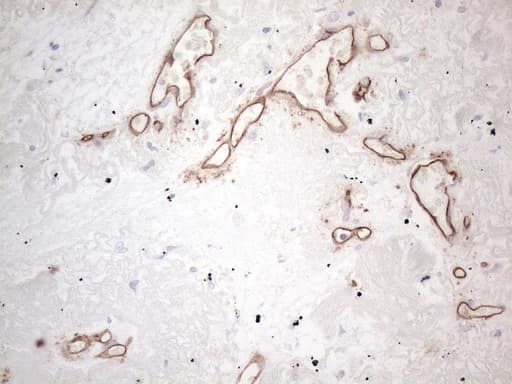 CD34 Antibody (aa312-385, clone OTI11A5)