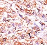 Polyclonal Rabbit anti-Human GUCY1A2 Antibody (aa105-136, IHC, WB)