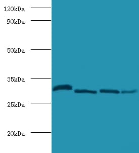 IHC-plus™ CA2 / Carbonic Anhydrase II Antibody (aa2-260)