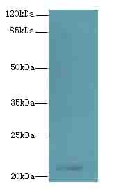 Polyclonal Rabbit anti-Human TMEM154 Antibody (IHC, WB)