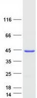 Human CLTA / LCA Protein (Recombinant Myc-DDK (Flag))