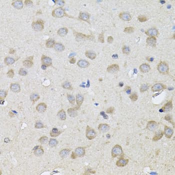 SPR Antibody