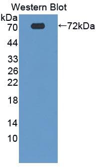 PROZ / Protein Z Antibody (aa23-399)