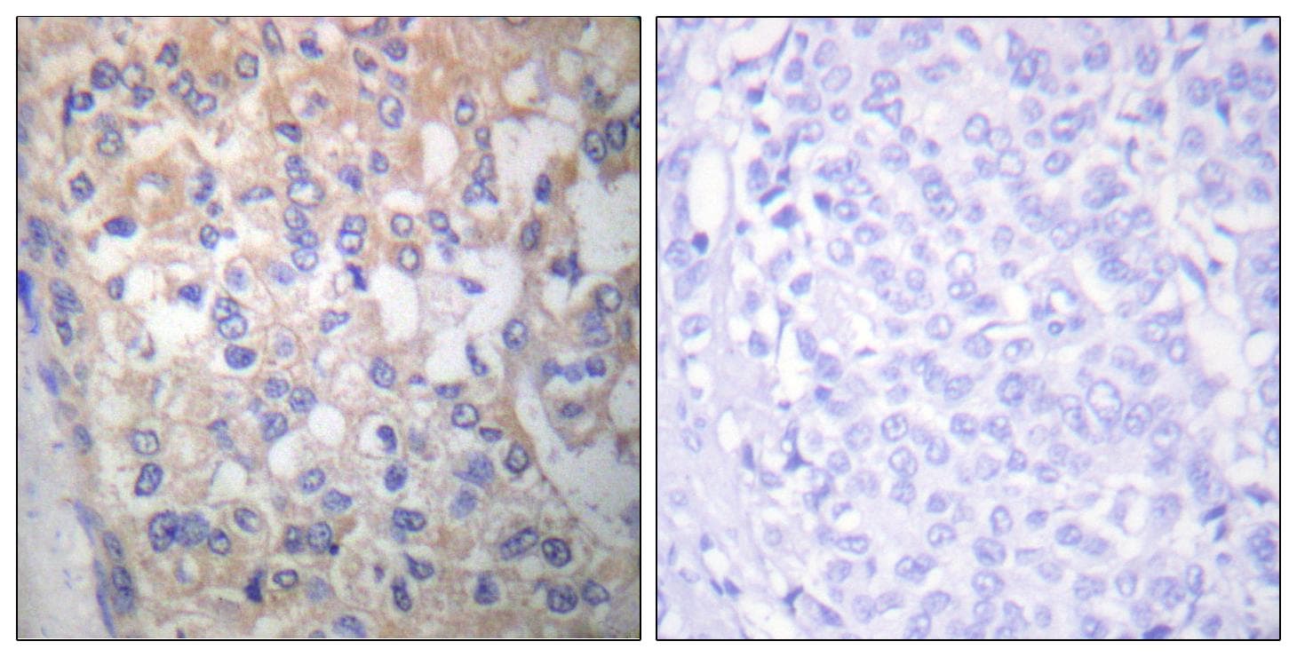SYN / FYN Antibody (phospho-Tyr530)