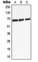 ADRB2 Antibody (Internal)