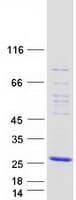 Human GMF Beta / GMFB Protein (Recombinant Myc-DDK (Flag))