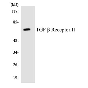 Polyclonal Rabbit anti-Human TGFBR2 Antibody (aa73-122, WB)