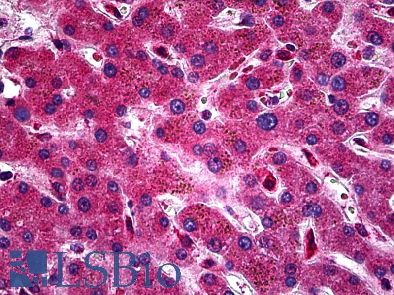 IHC-plus™ Polyclonal Rabbit anti-Human ZEB2 / SIP-1 Antibody (aa71-120, IHC, WB)