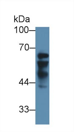 IGF2BP2 Antibody (aa141-384, Biotin)