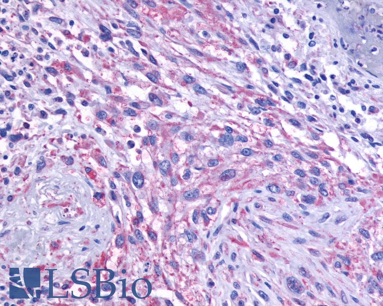 PathPlus™ Polyclonal Rabbit anti-Human GRM1 / MGLUR1 Antibody (C-Terminus, IHC)