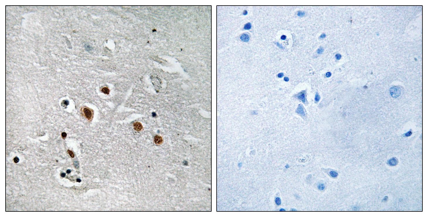 MED13L Antibody