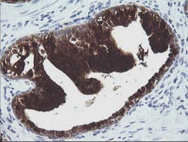 CMPK / CMPK1 Antibody (clone OTI1A1)