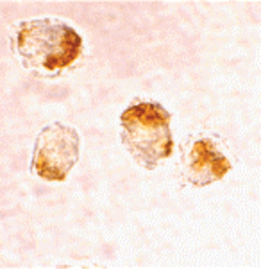 BAX Antibody