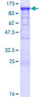 Human SCYL3 Protein (Recombinant GST)