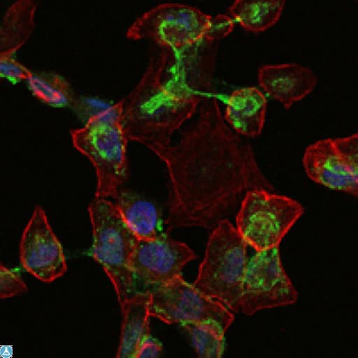 APOB / Apolipoprotein B Antibody