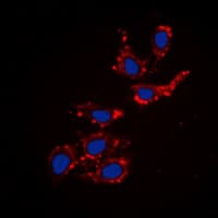 Endostatin Antibody (Internal)