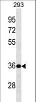 Polyclonal Rabbit anti-Human MCNAA / BPHL Antibody (aa96-124, WB)