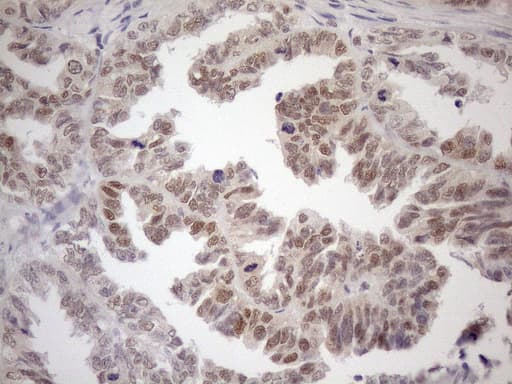 MGMT Antibody (clone OTI4F9)