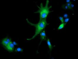 ALDH1L1 Antibody (clone OTI3D2)