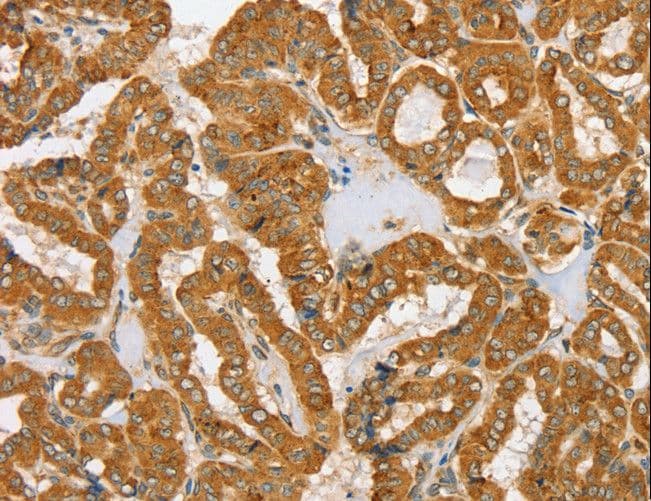 PDP1 Antibody