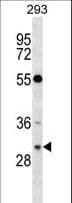 IHC-plus™ RASD2 Antibody (aa86-114)