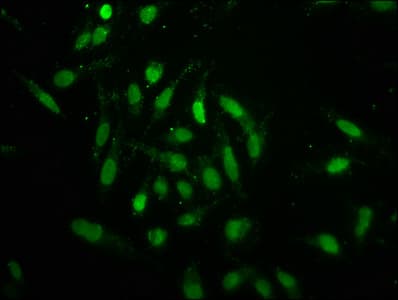 HIST1H1C Antibody