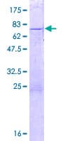 Human ZNF659 / ZNF385D Protein (Recombinant GST)