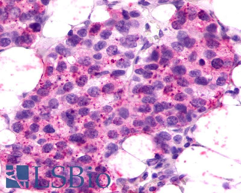 PathPlus™ Polyclonal Rabbit anti-Human CXCR2 Antibody (Extracellular Domain, IHC)
