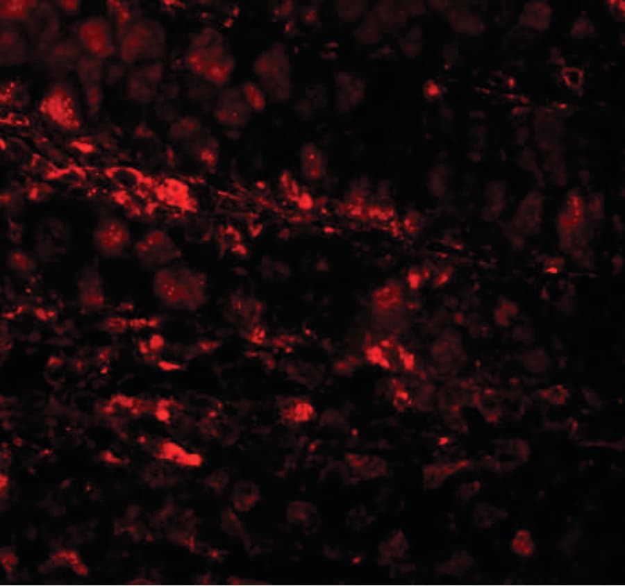 IHC-plus™ ESRP1 / RBM35A Antibody