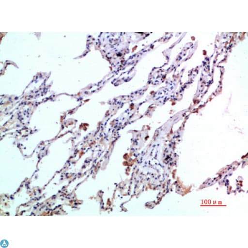 CCL24 / Eotaxin 2 Antibody