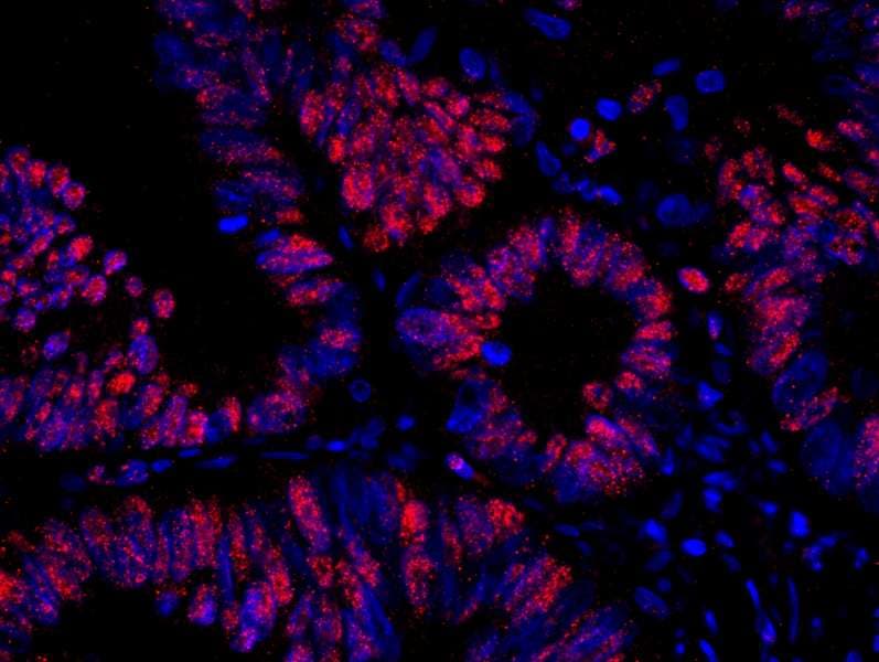 IHC-plus™ RANBP3 Antibody (aa150-200)