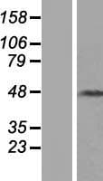 KRT31 / Keratin 31 / KRTHA1 Protein (Over-Expression Lysate Myc-DDK (Flag))