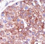 Polyclonal Rabbit anti-Human SMURF1 Antibody (aa711-740, IHC, WB)