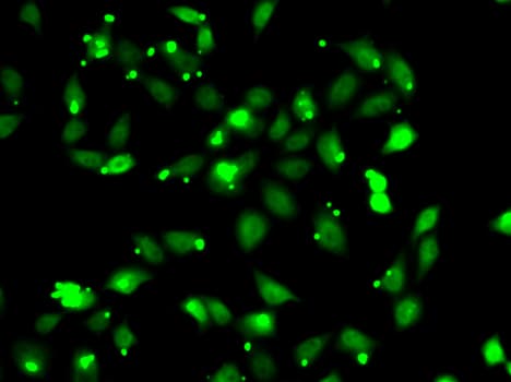 Complement C1s Antibody