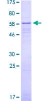 Human KCNQ2 Protein (Recombinant GST)